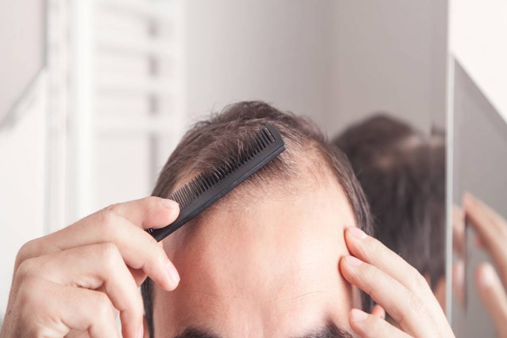 Erkeklerde Saç Dökülmesi Neden Olur?