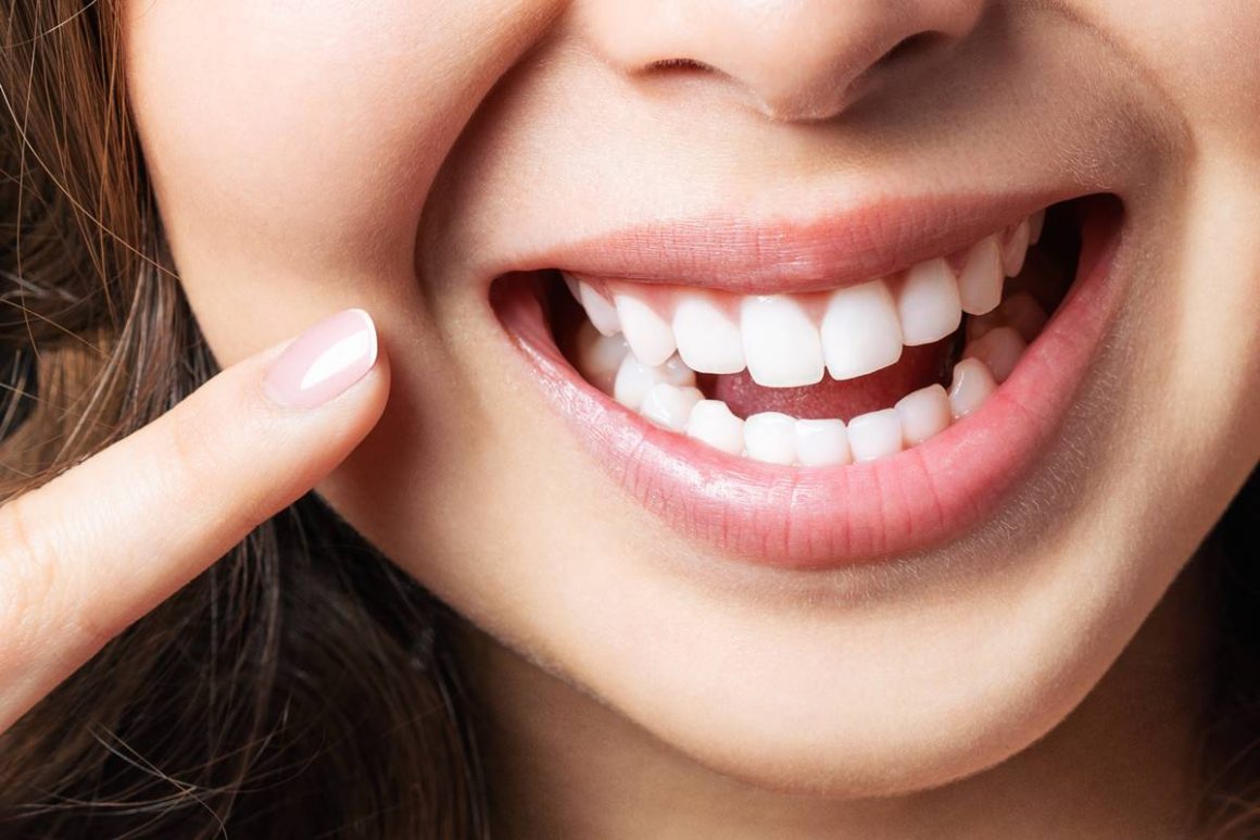 Diş Taşı Nasıl Temizlenir? Zararlı mıdır? Temizleme Fiyatları