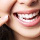 Diş Taşı Nasıl Temizlenir? Zararlı mıdır? Temizleme Fiyatları