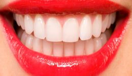 Diş ile İlgili Bilmeceler