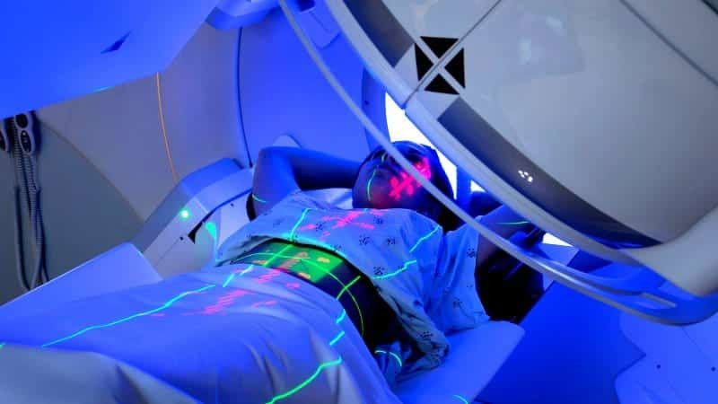 Radyoterapi tedavisi (ışın tedavisi) nasıl uygulanır?