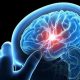 epilepsi-neden-olur-bulasici-midir-belirtileri-ve-tedavi-yontemleri-hakkinda-7513