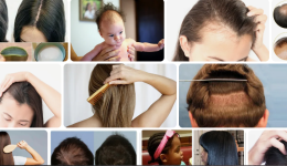 Alında Çıkan Kısa Bebek Saçları Nasıl Uzar?