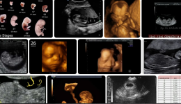 Hamileliğin 7. Haftasında Bebek Kaç mm Olur? Ultrasonda Nasıl Görünür Kaç Gramdır?