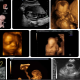 hamileligin-7-haftasinda-bebek-kac-mm-olur-ultrasonda-nasil-gorunur-kac-gramdir-34372