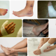 parmaklarin-burkulmasina-incinmesine-ne-iyi-gelir-ayak-parmagi-burkulmasina-bitkisel-tedavi-79417